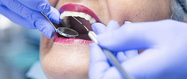 Best Emergency Dentist for Lost Fillings or Crowns in Altoona, PA